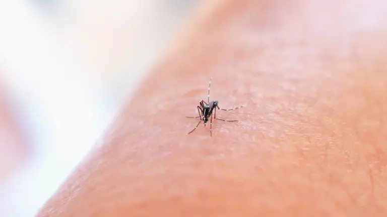 Erkės įkandimas po išvykos: simptomai, kurių neignoruoti